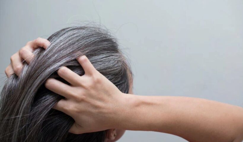 White Hair Home Remedies