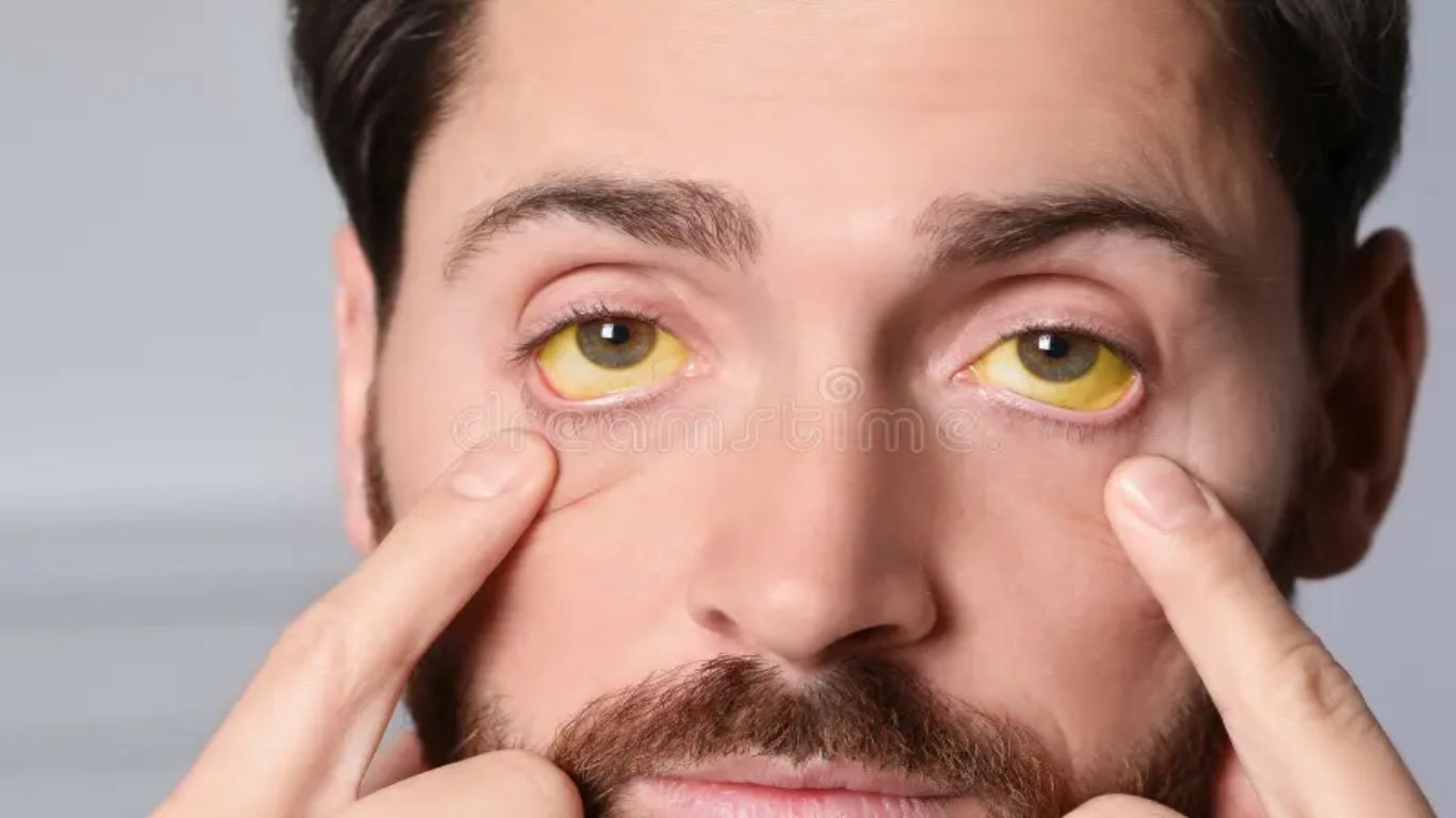Eyes