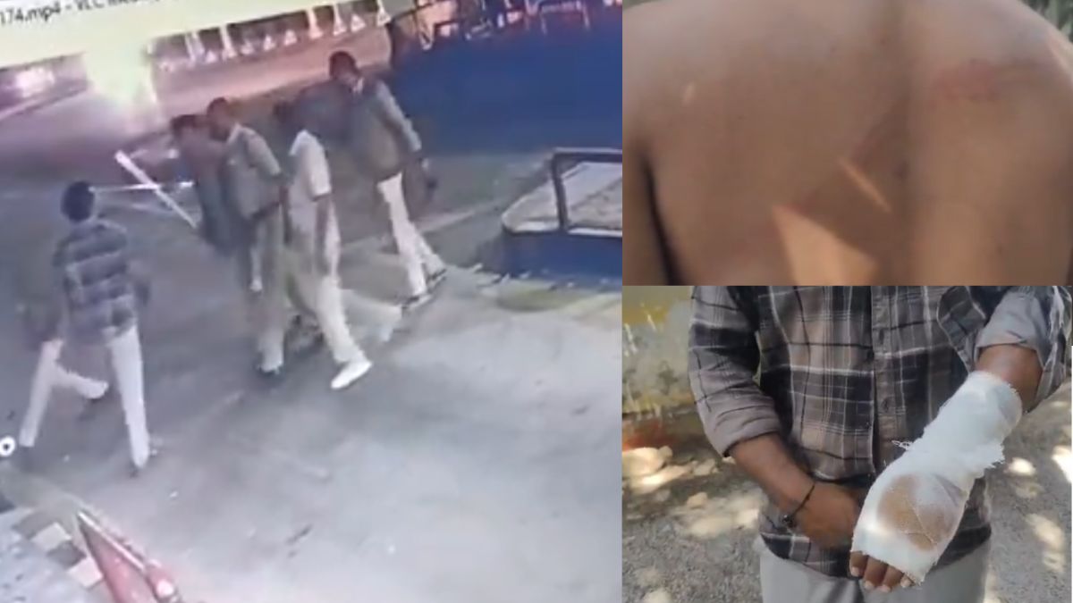 Police attack on citizen: