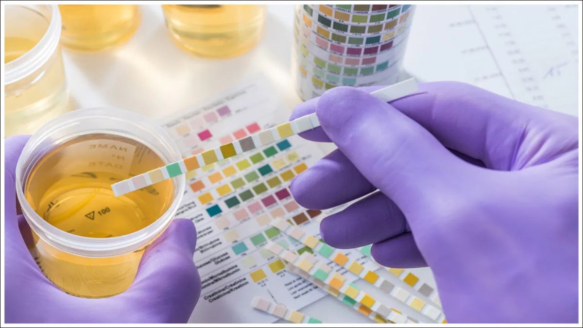 Urine Colour