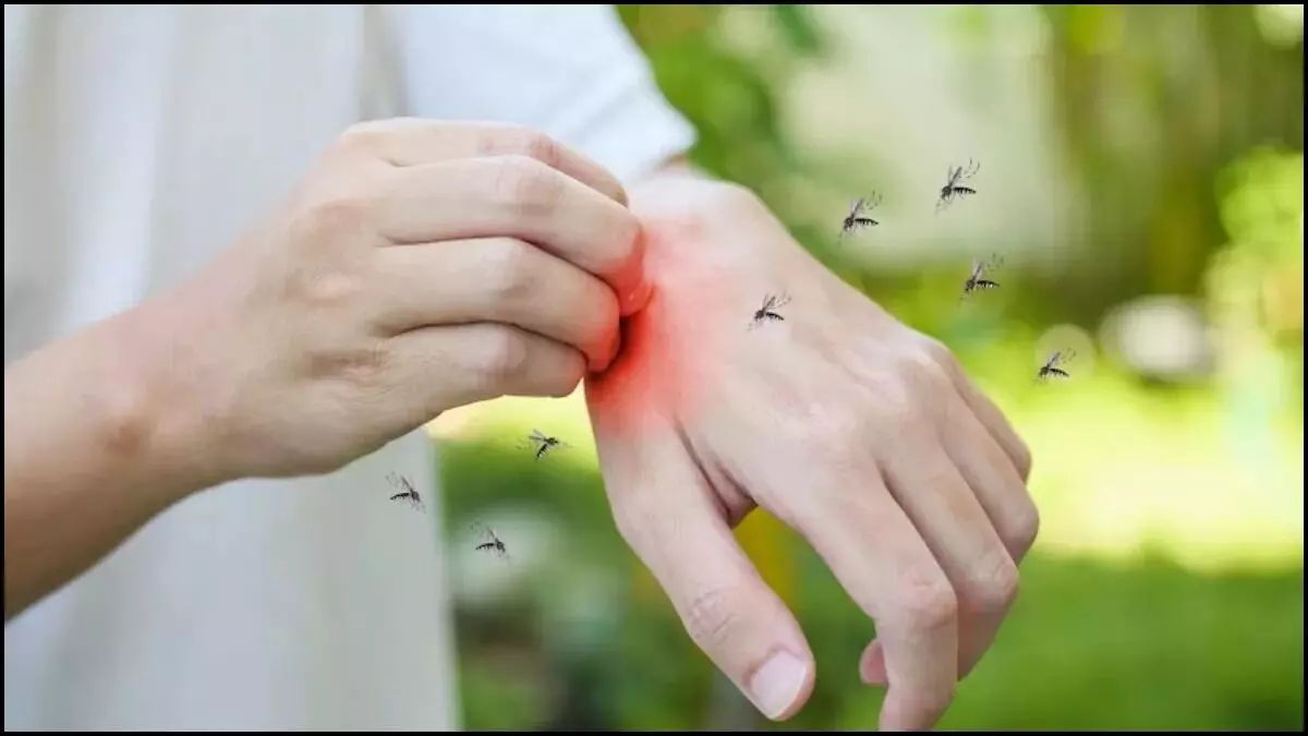 How To Get Rid of Mosquitoes