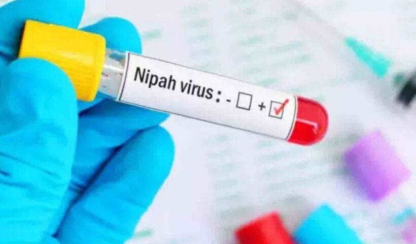 Nipah Virus