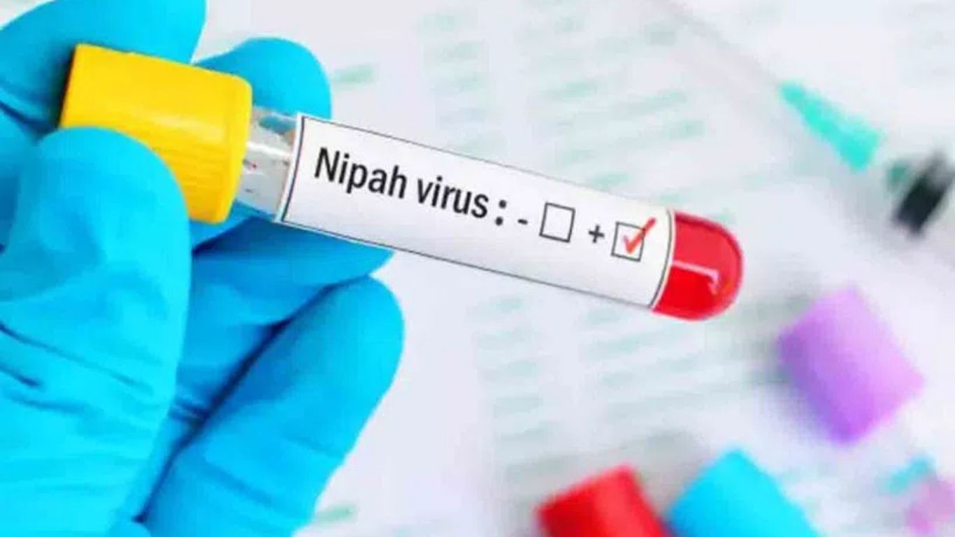 Nipah Virus