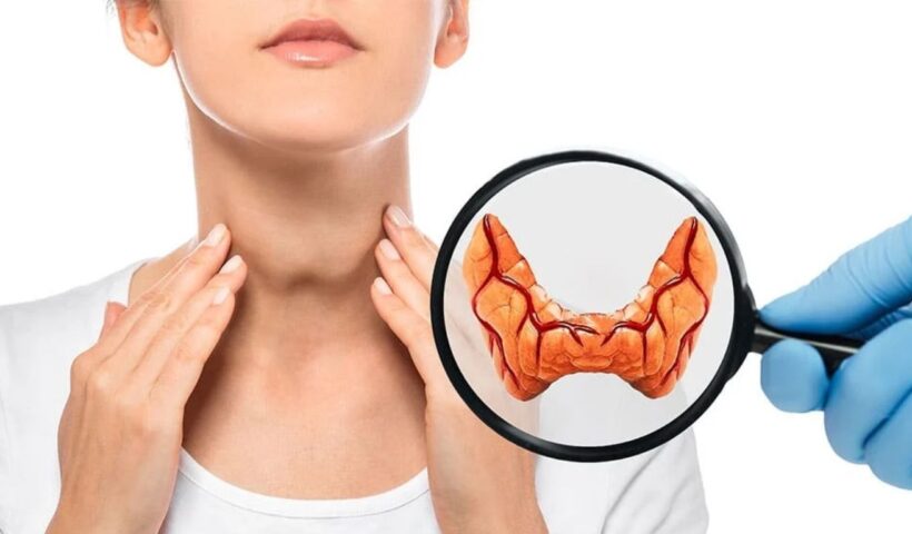Thyroid