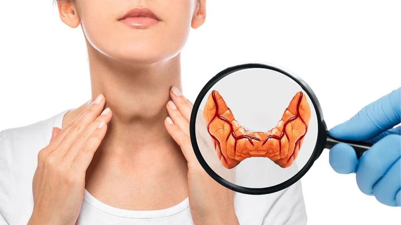 Thyroid