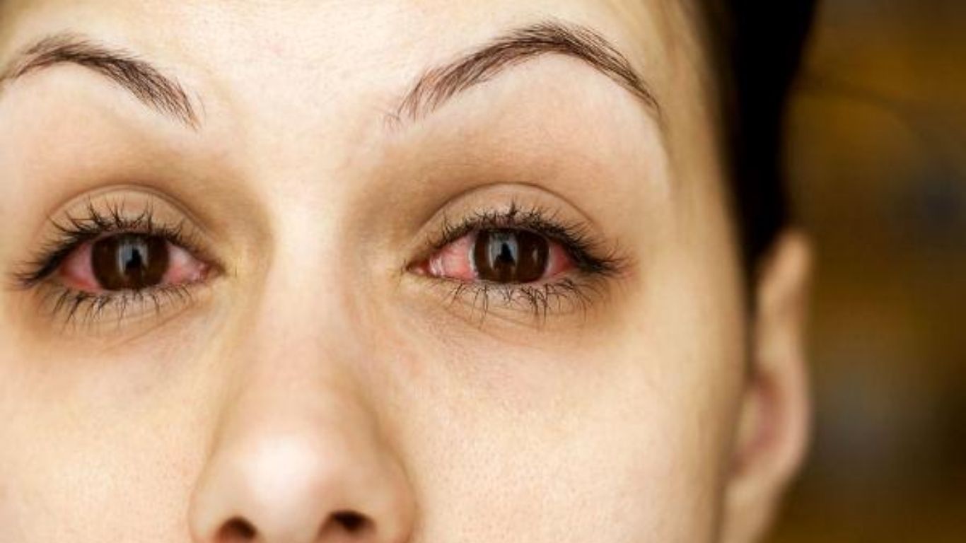 Eye Care Tips