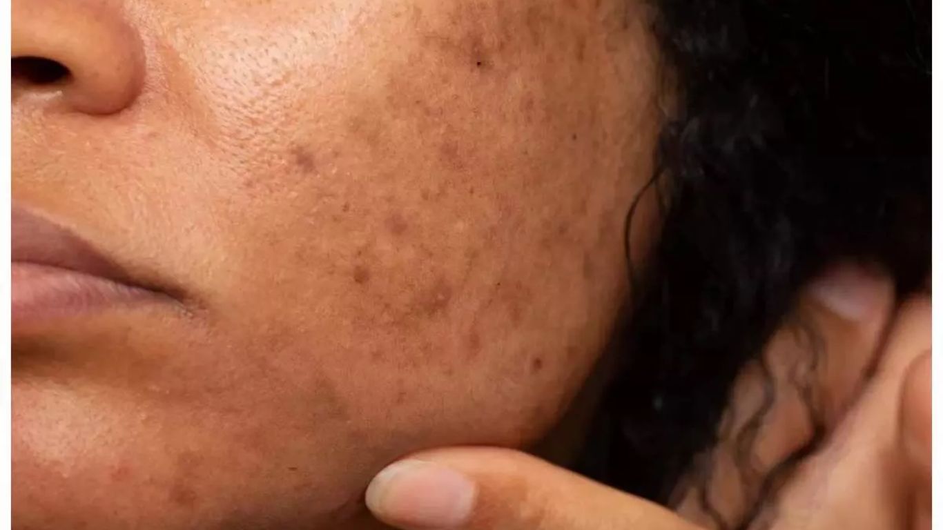 Skin Care Tips