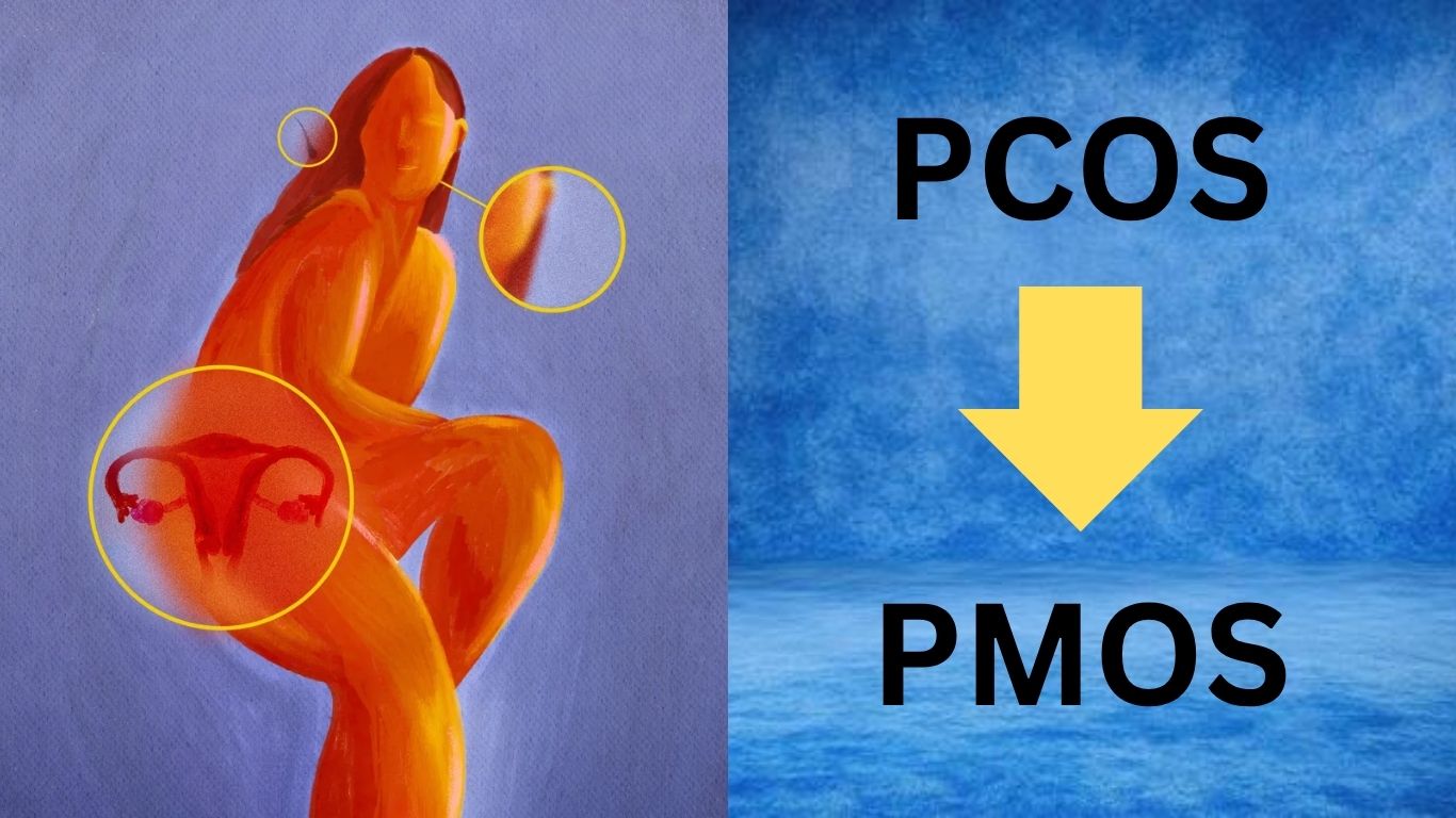 PCOS