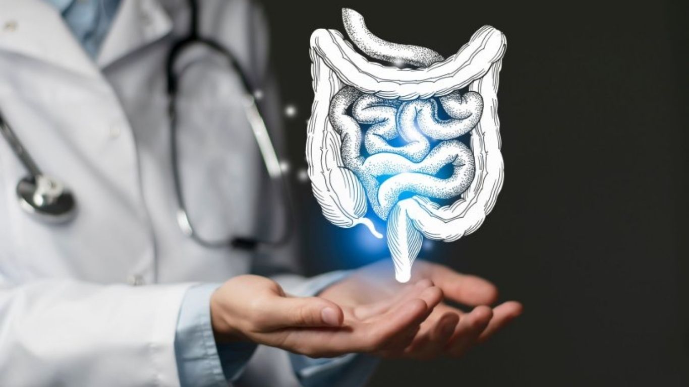 Colon Cancer: